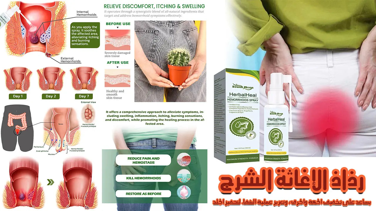 رذاذ علاج البواسير