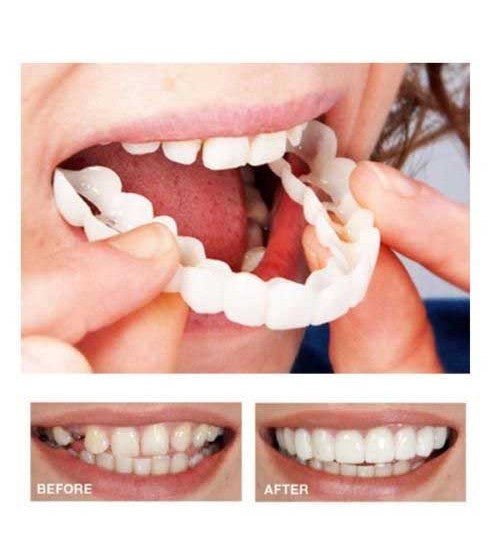 SNAP ON SMILE™ ابتسامة هوليود - Gulf Shop KSA